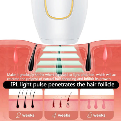 Depiladora IPL laser